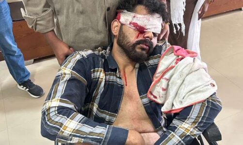 दीपावली पर हादसा: पटाखा फटने से युवक की आंख झुलसी, हायर सेंटर रेफर